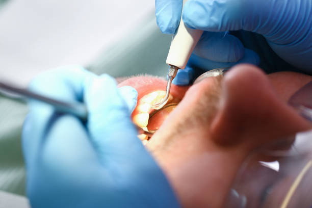 Best Tooth Infection Emergency Dentist  in Whittingham, NJ