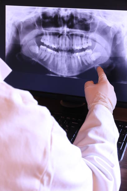 Best Chipped Tooth Repair Near Me  in Whittingham, NJ